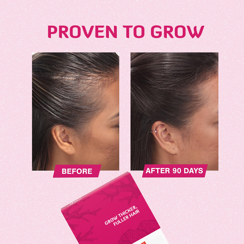 120mcg Biotin-Haarwuchsmittel für das Haarwachstum