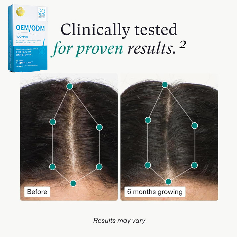 OEM Haarwachstum Nahrungsergänzungsmittel Haarwachstumspillen für starkes natürliches Haarwachstum