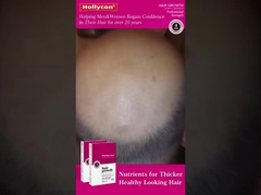 Rothaarvergrößerungspillen